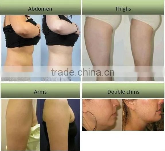 5 in 1 ultrasonic cavitation for beauty salon use