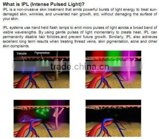 photorejuvenation ipl treatment day spa equipment