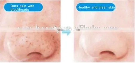 Electric facial cosmetic cleaner,face skin cleaning brush with best design -JTLH-1501