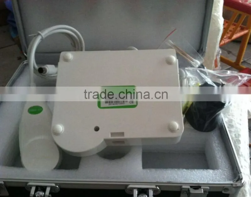 new products looking for distributor magic mirror skin and hair scanner 5.0 MP High Resolution CCD USB skin analyzer