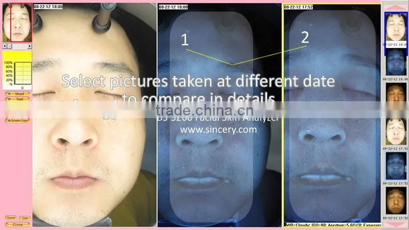 Wood Lamp Scanner Machine For Facial Skin Analysis