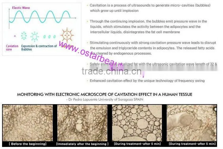 Hot shapers ultrasonic cavitation weight loss device home use C-01