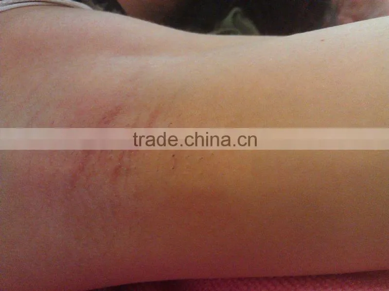 lady epilator hair removal face/good quality device for hair removal face