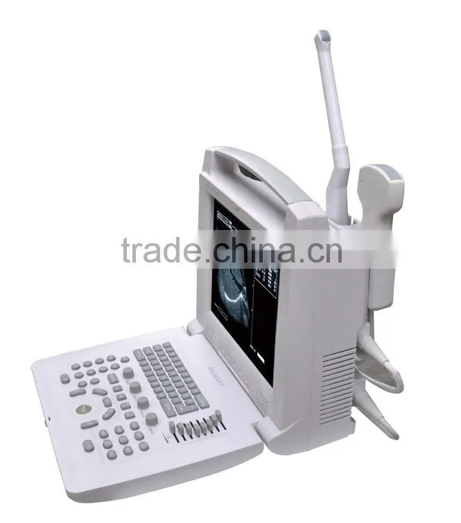 imported 12 " LCD Handled USB B Ultrasound machine in white color