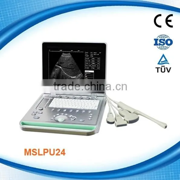 MSLHU03 new and best home ultrasound machine china