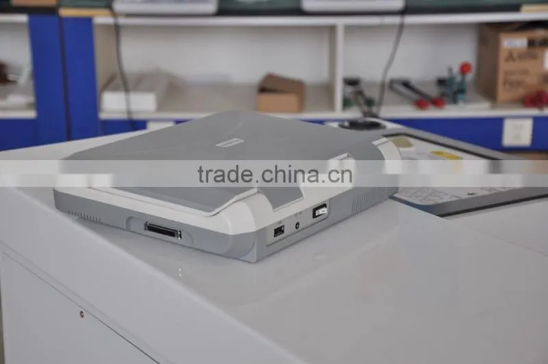 cheap Laptop Ultrasound scanner/ultrasonic equipments price 3018
