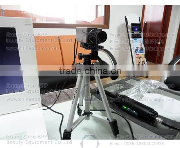Infrared Mammary Gland Diseases Detector Women Breast Biopsy Analyzer Machine