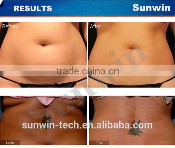 New Arrival!!!650nm diode laser slimming machine for sale!