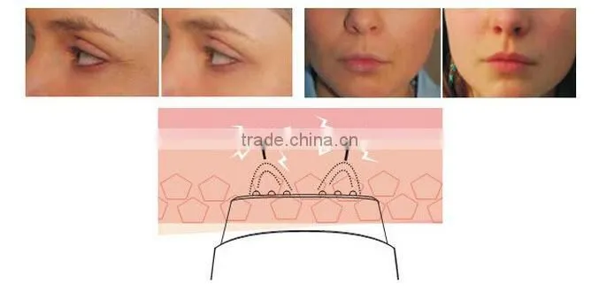 good seller radio frequency skin health device for women use facial toner machine with heat energy