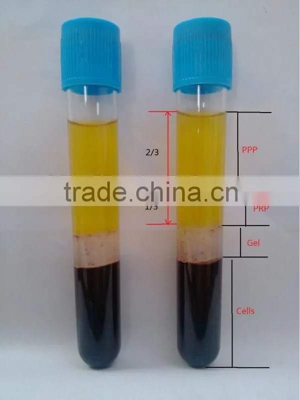 Supply sterile PRP tube for facial treatment