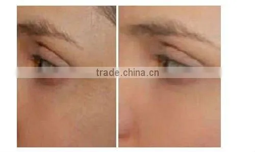 Almighty Oxygen Jet Facial Beauty Machine