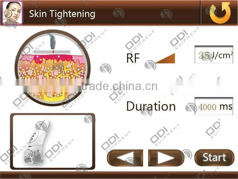 (CE-Certified)Multifunctional beautymachine- laser tattoo removal machine with ipl hair removal and RF (IRL10)
