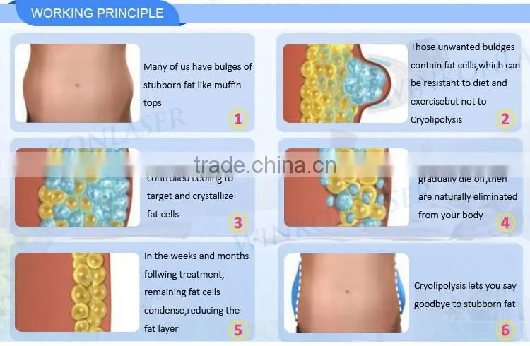price cryolipolysis / cryolipolysie / cryolipolysis body slimming machine