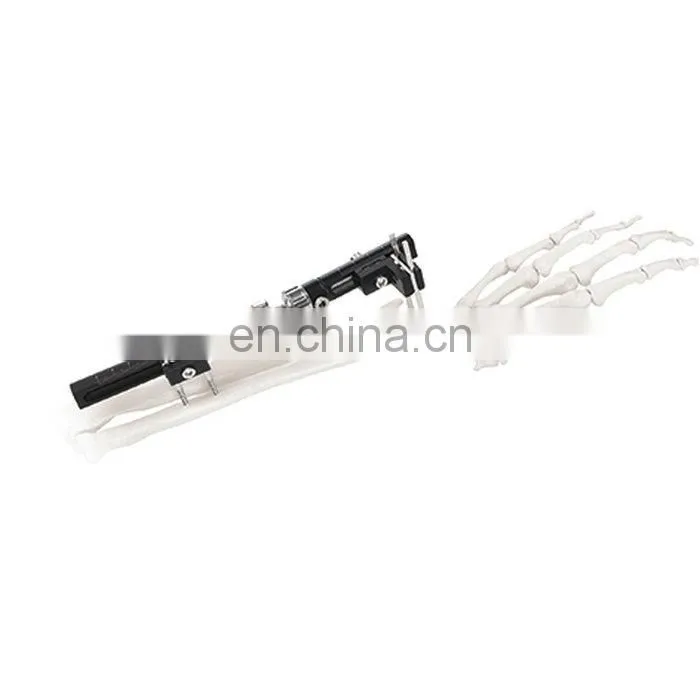 High Quality Wrist Joint External Fixator Orthopedic Surgical Instrument