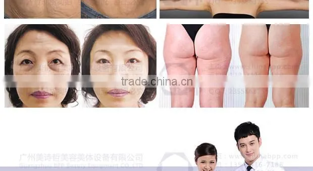 2015Best products ultrasonic cavitation equipment for body's metabolism accelerating
