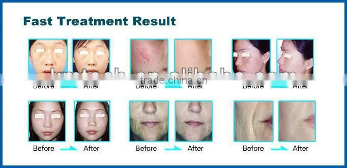Most poopular electronic multifunction beauty equipment
