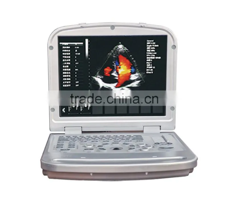 15 inch laptop Color Doppler 64G image-storage capacity ultrasound scanner for hospital