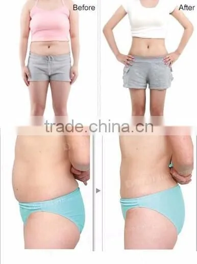 100mw 650nm lipo laser for sale/portable lipolaser slimming machine price lipolaser
