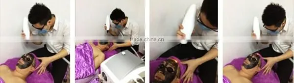Hot Sale 3 in1 Q-switch E Light Rf+ipl Hair Removal Yag Laser Tattoo Removal Beauty Machine