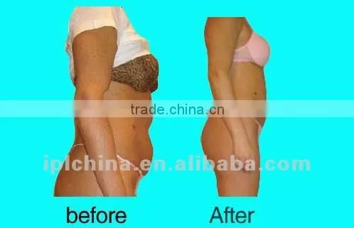 New Cavitation Beauty Instrument to Repel Cellulite