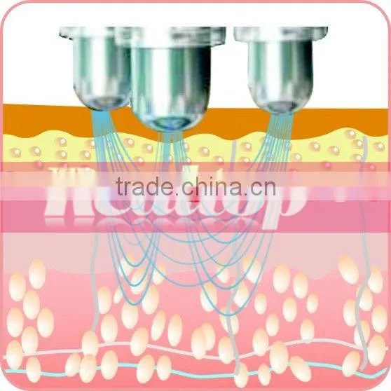 Korea RF beauty machine radio frequency facial machine for home use skin tightening