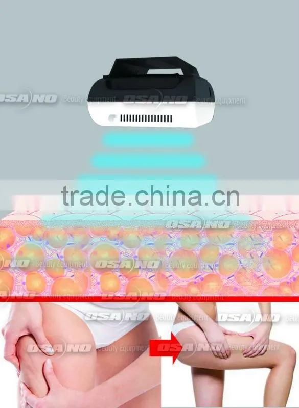 Mini Cryolipolysis Machine,Cryotherapy Beauty Slimming Machine Home Use