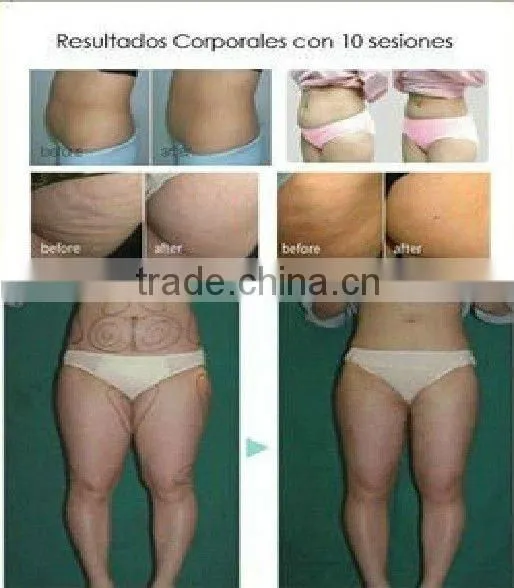 VY-M2A Home use ultrasonic vacuum cavitation machines for body slimming