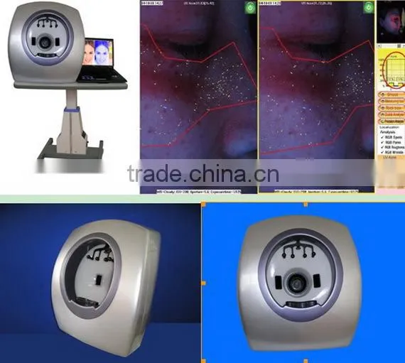 high pixel skin analyzer, skin analysis machine