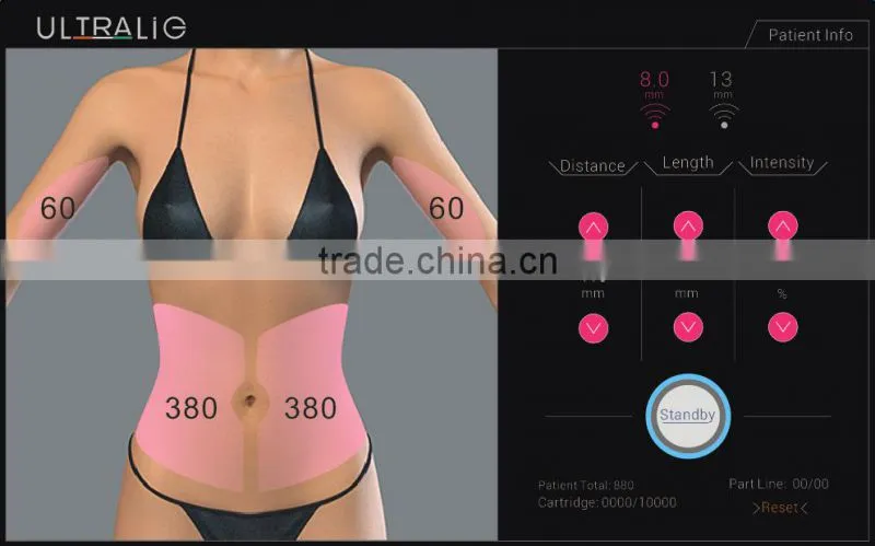 Hifu High Intensity Focused Ultrasound Skin Tightening Machine S90