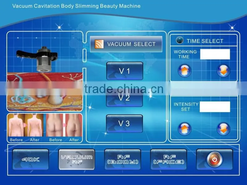 portable ultrasound cavitation RF vacuum therapy machine for body slim