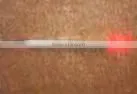 Low power fiber diode laser therapy laser for Tinnitus, Rhinitis