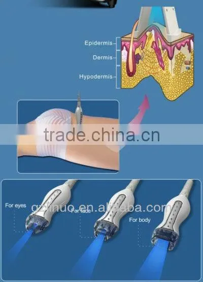 2013-2017 popular RF laser vacuum latest technology (The newwest technology !!!!!!!!!)
