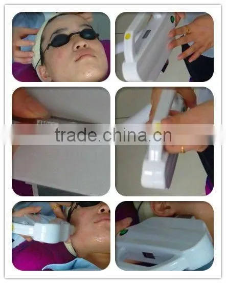 Professional 532nm, 1064nm ND Yag Laser hair removal, tattoo removal Multifunction Beauty Equipment