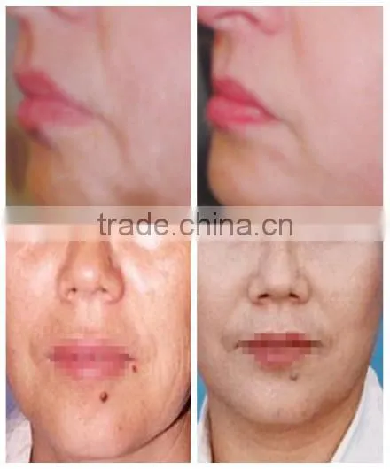Beauty salon use rf body slimming machine