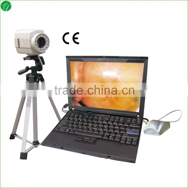 Digital laptop colposcope