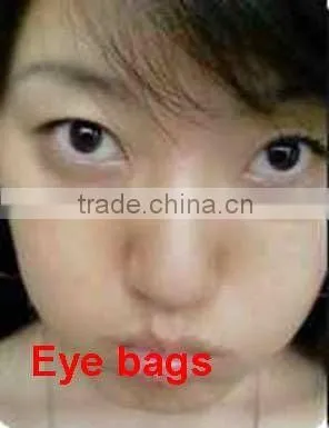 Bonni eye care system with unqie technology combine cosmetic better effect