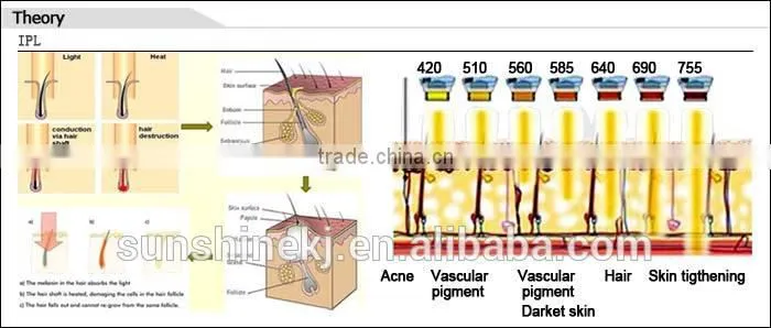IPL Hair Removal Skin Rejuvenation Vascular&Acne Removal Beauty Salon Equipment&Machine