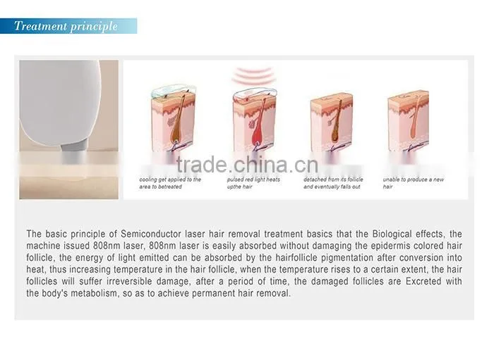 Sale promotion!!!! nubway laser spa use 808nm diode laser machine for hair removal