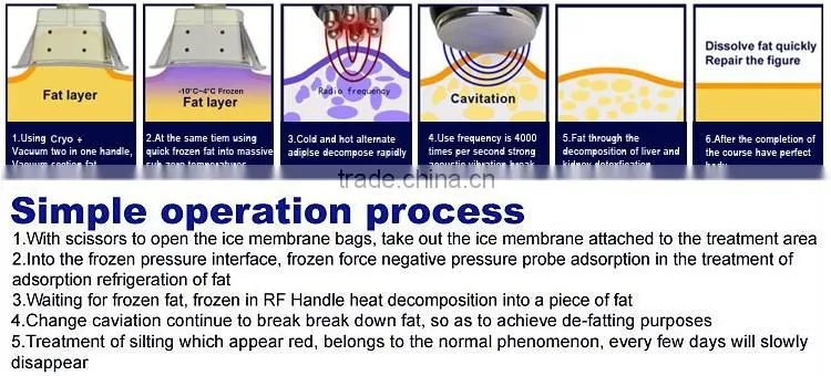 China Supplier! Cryotherapy machine whole body for sale/Fat Freezing machine home device