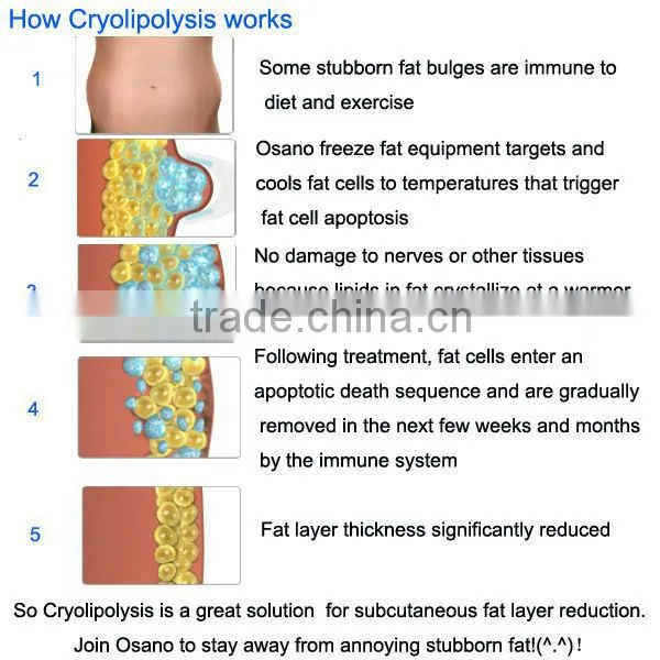 2014 cryotherapy Mini Cryolipolysis machine cryolipolysis machine equipment for home use