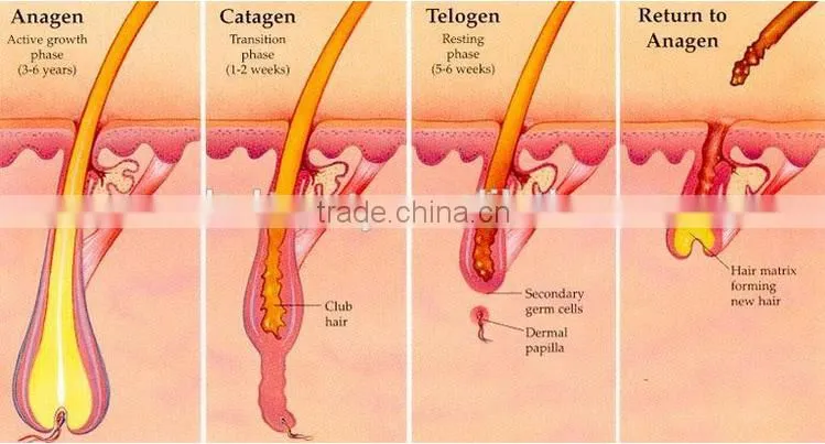 Safe And Effective Portable 808 Diode Laser Treatment For Unwanted Hair Removal From Face By Laser