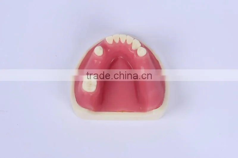 Trade Assurance Hot Dental Implant System CE Approved Dental Implant Model