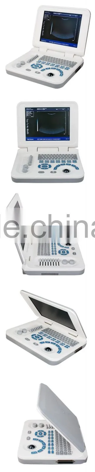 RUS-9000F2 CE&ISO easy carrying portable ultrasound scanner price