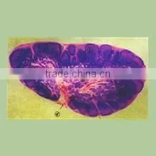 lymph node microscope slide