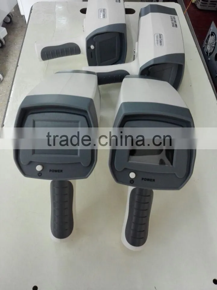 Self Exam Colposcope