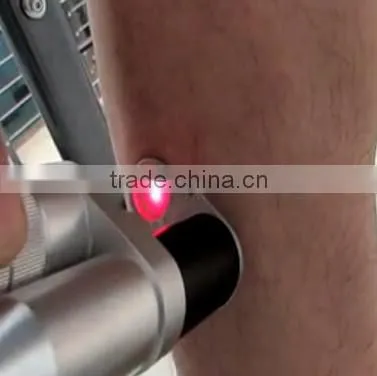 alexandrite laser 755nm hair removal equipment /Alex laser hair removal equipment