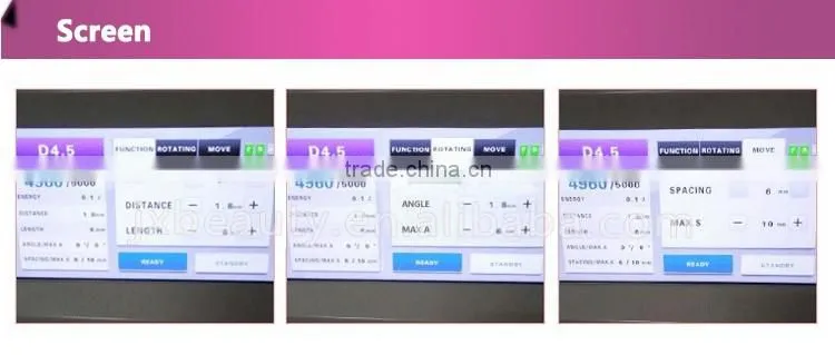 2016 Good effect 25mm focal length hifu vaginal tightening machine with CE certificate