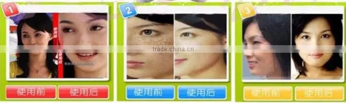 Multifuncational 3mhz ultrasonic facial skin scraper beauty machine for sale
