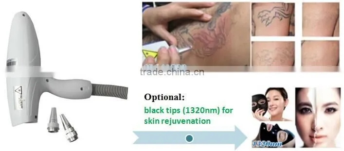 Super shr hair removal machine with nd yag laser system