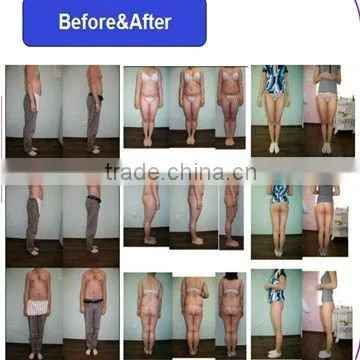Mini Ultrasound Liposuction Machine